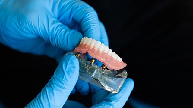 Quels sont les types de prothèses dentaires et leurs rôles respectifs ?