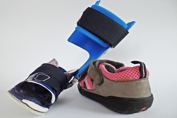 Orteils en marteau : combien de temps porter des chaussures orthopédiques ?