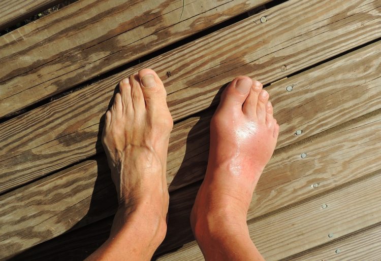 Quelles sont les causes les plus courantes de douleurs au pied ?
