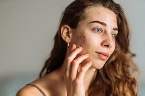 Le guide des actifs les plus efficaces pour traiter les taches pigmentaires.