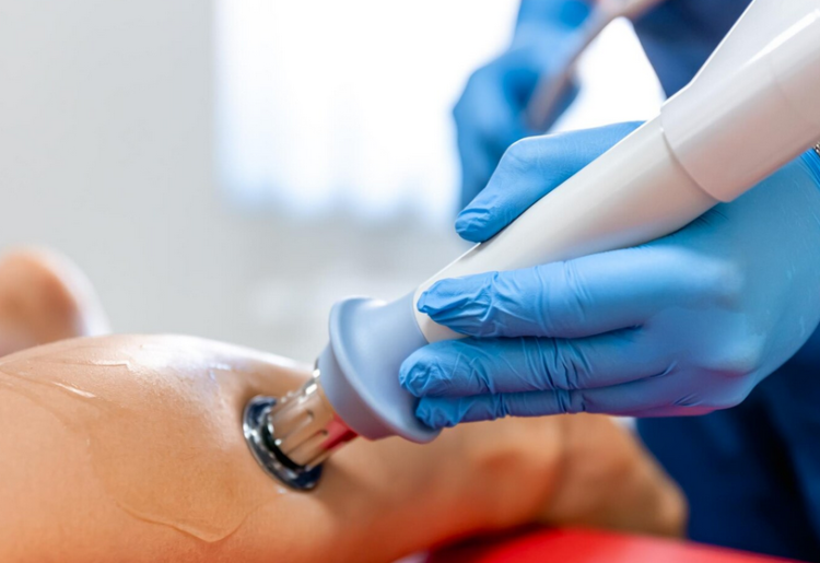 Traitement des varices au laser : pour qui et dans quels cas ?
