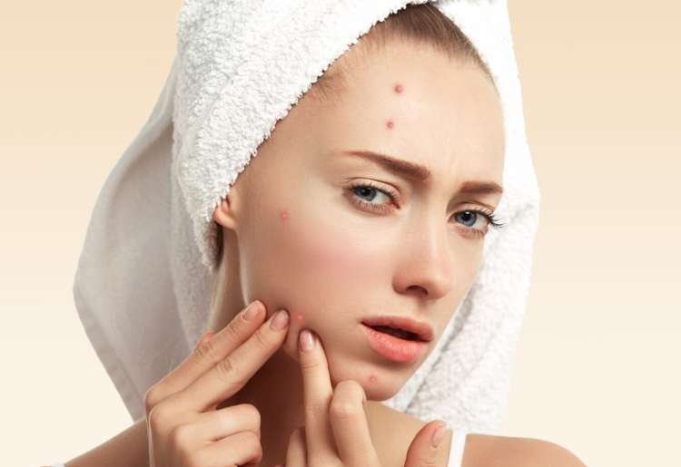 Le « pimple patch » : le soin ciblé discret et efficace contre les boutons blancs